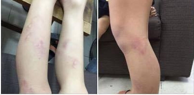 Chủ tịch Hà Nội yêu cầu làm rõ vụ 11 học sinh lớp 2 bị giáo viên đánh ảnh 1